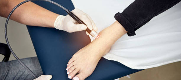 physical therapy laser treatment